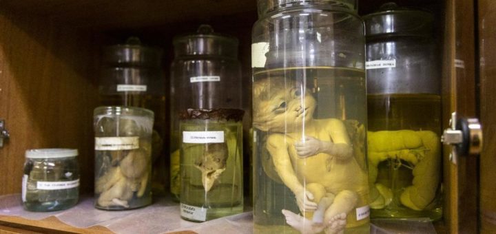 Тульские патологоанатомы показали коллекцию образцов новообразований